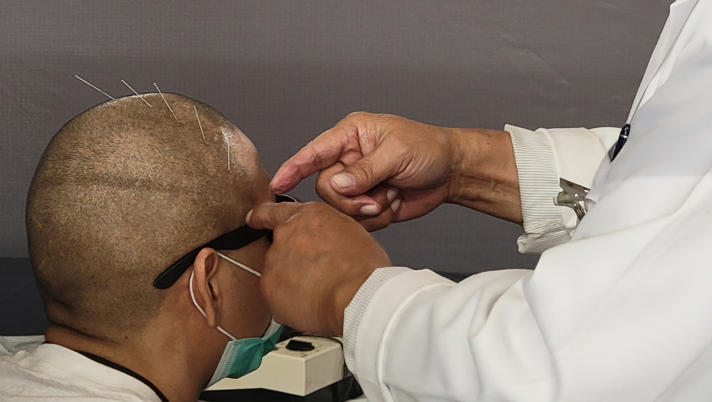 病患正在接受紀榮元醫師的針灸服務。攝影／劉昇平