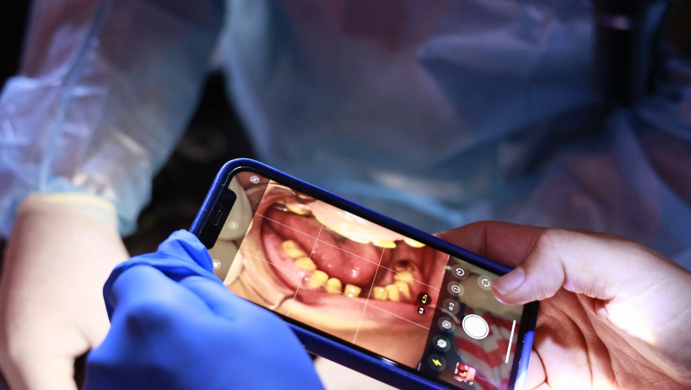 Mobile phone photos of Ana Karen’s missing teeth and oral condition help her mother understand the severity of her daughter’s dental problems. Photo/Shuli Lo