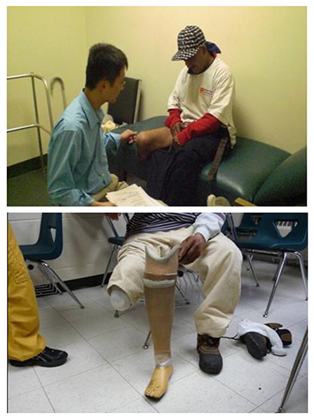 長島物理治療師蔡逸杰（上圖，左） 協助裝義肢